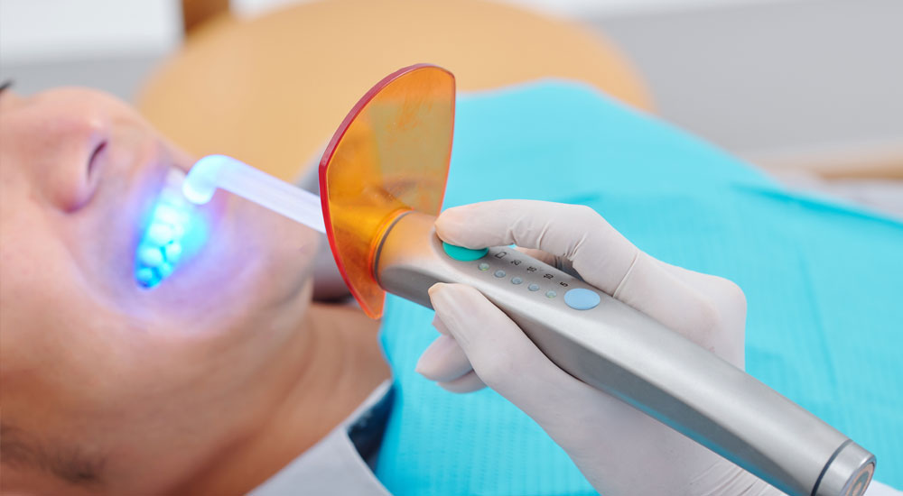 Teeth Whitening