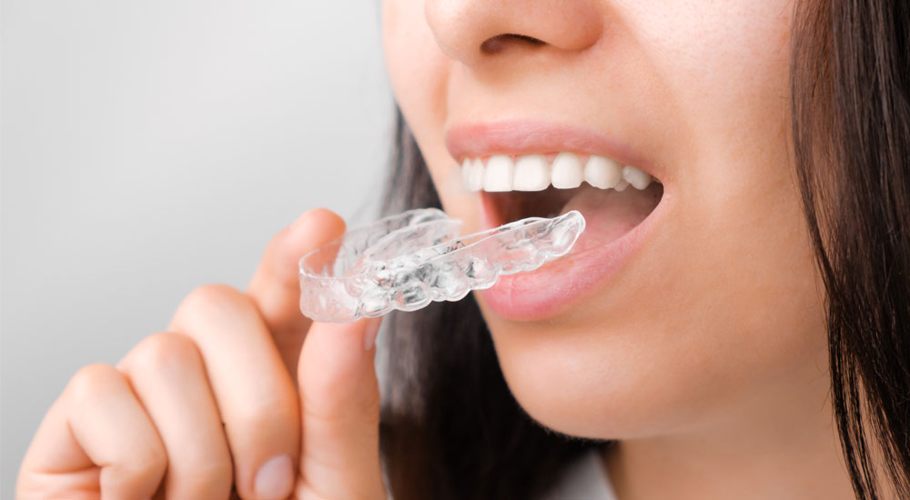 Wireless Orthodontic Treatment